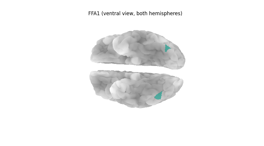FFA1 (ventral view, both hemispheres)